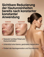 Klare Haut. Straffer. Jünger. LUMÉRA GlowStick 4 in 1